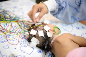 Crises convulsivas e epilepsia
